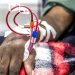 Sécurité des patients dans les formations sanitaires : Benjamin Hounkpatin appelle les acteurs à une conjugaison des efforts